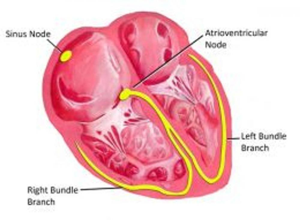 Big bigCover of Bradycardia: Causes, Symptoms and Treatments