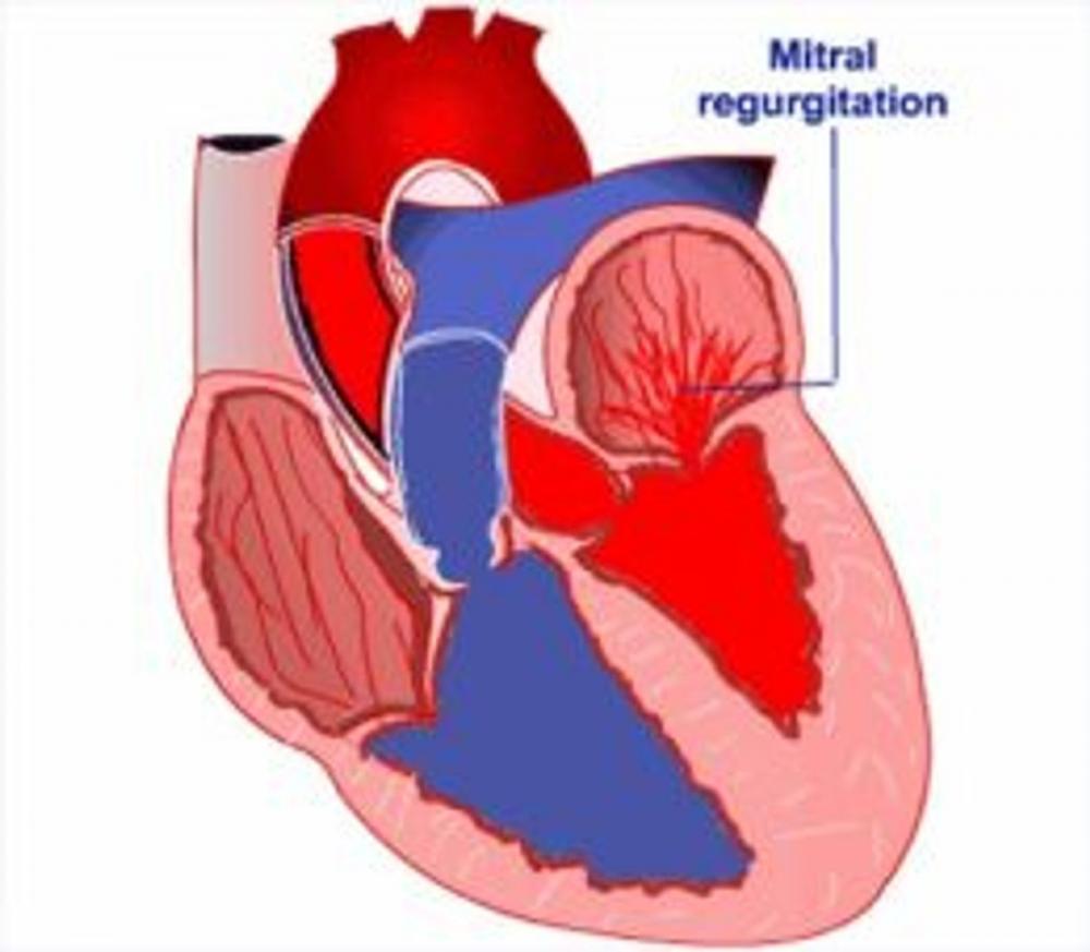 Big bigCover of Cardiogenic Shock: Causes, Symptoms and Treatments