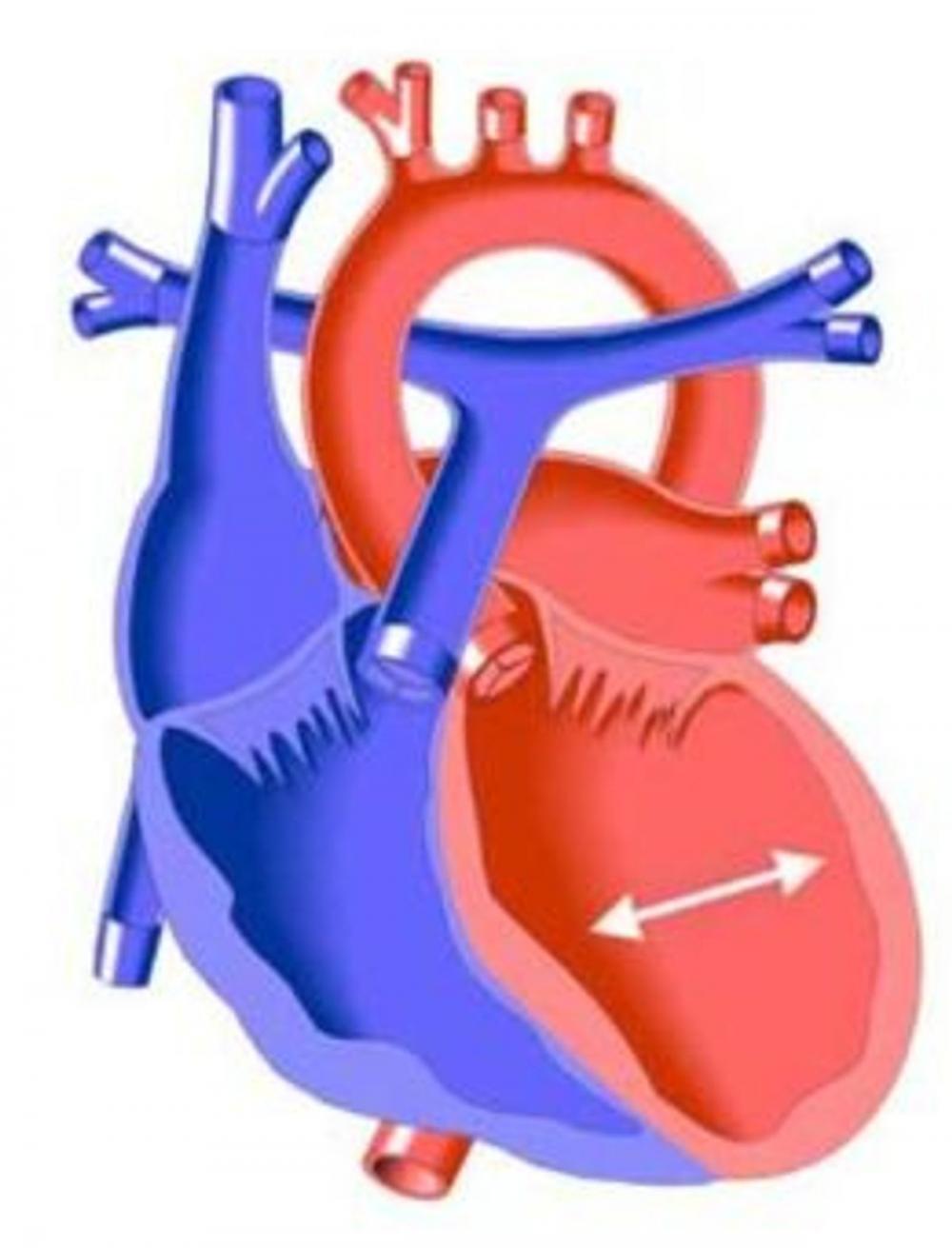 Big bigCover of Cardiomyopathy: Causes, Symptoms and Treatments