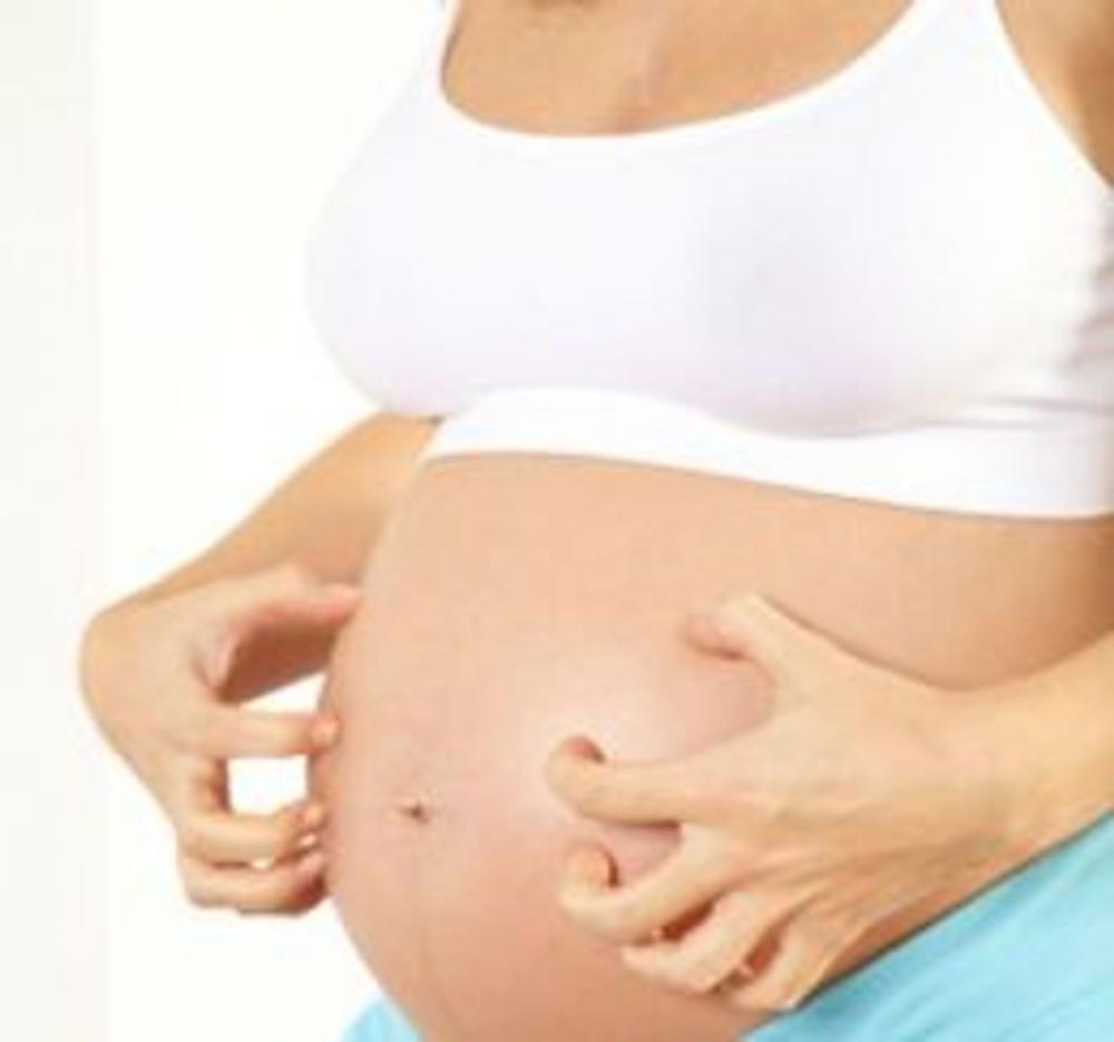 Big bigCover of Cholestasis of Pregnancy: Causes, Symptoms and Treatments