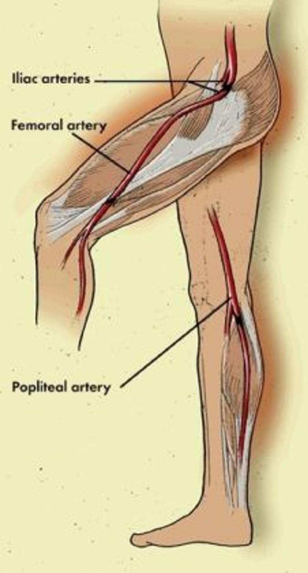 Big bigCover of Claudication: Causes, Symptoms and Treatments