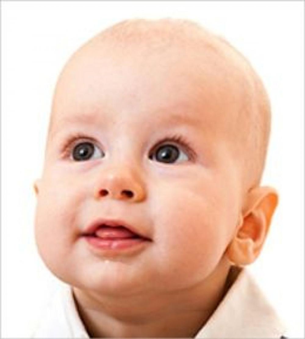 Big bigCover of Craniosynostosis: Causes, Symptoms and Treatments