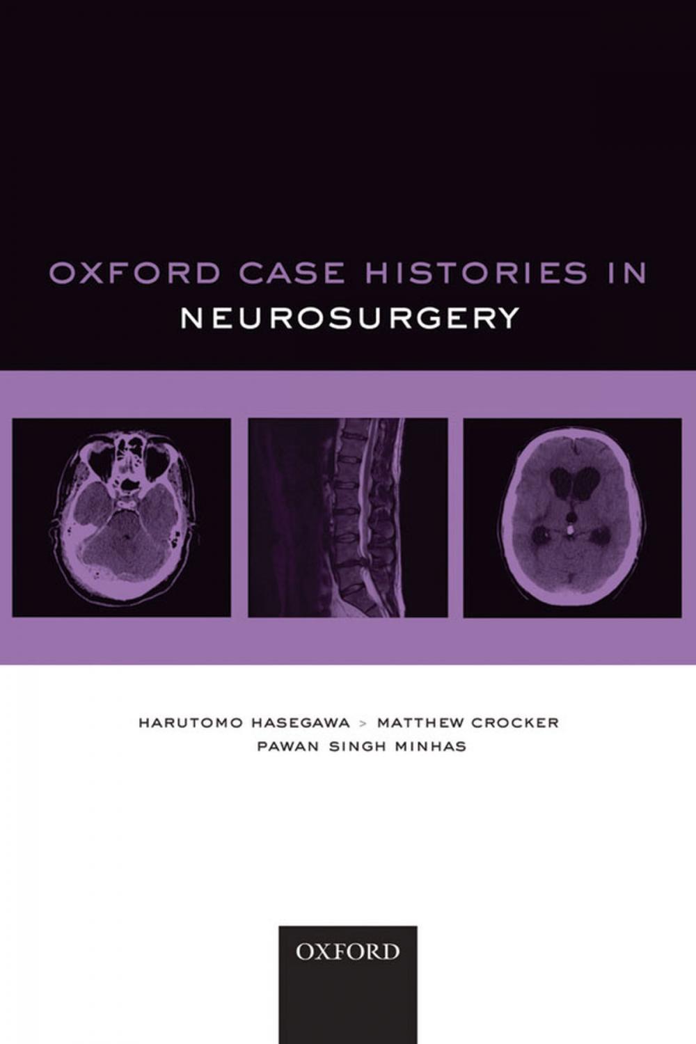 Big bigCover of Oxford Case Histories in Neurosurgery