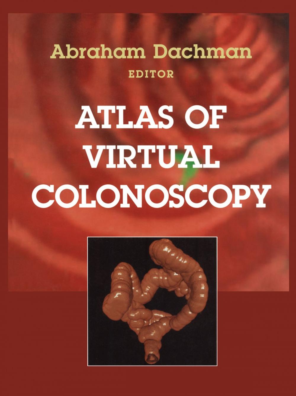 Big bigCover of Atlas of Virtual Colonoscopy