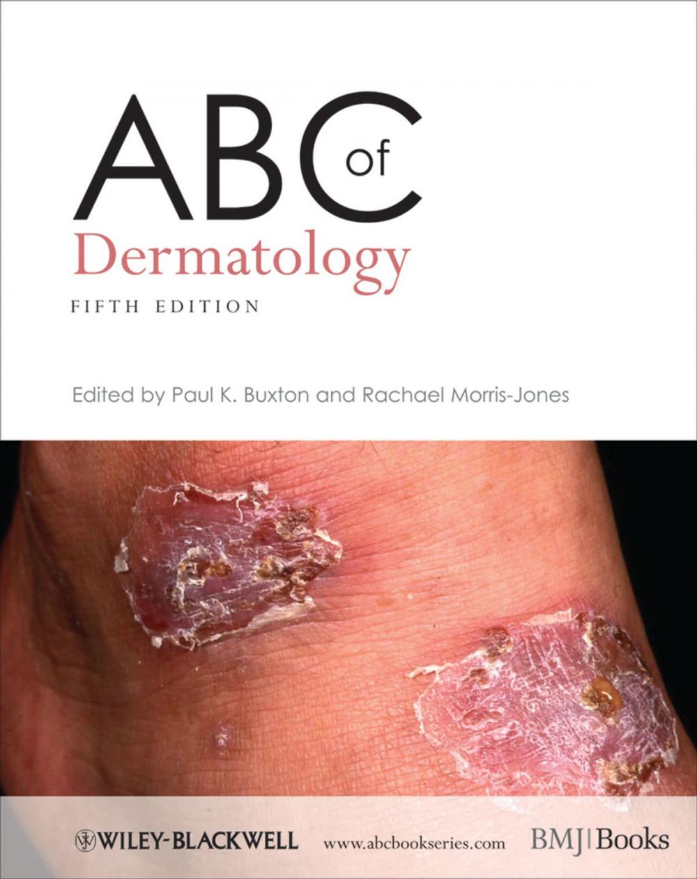 Big bigCover of ABC of Dermatology