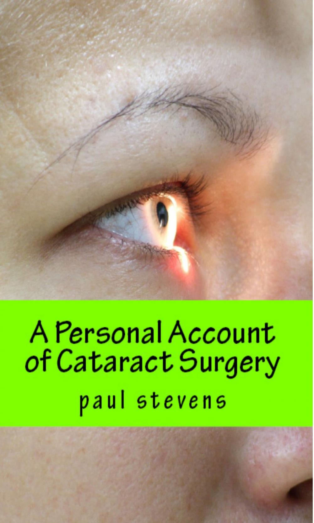 Big bigCover of A Personal Account of Cataract Surgery