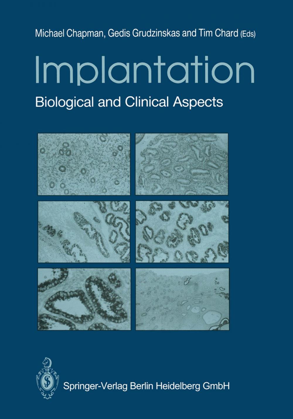 Big bigCover of Implantation