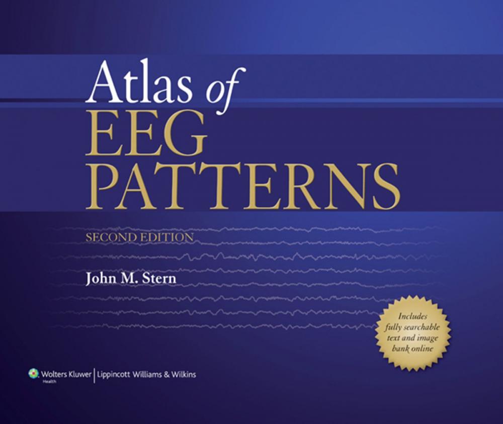 Big bigCover of Atlas of EEG Patterns