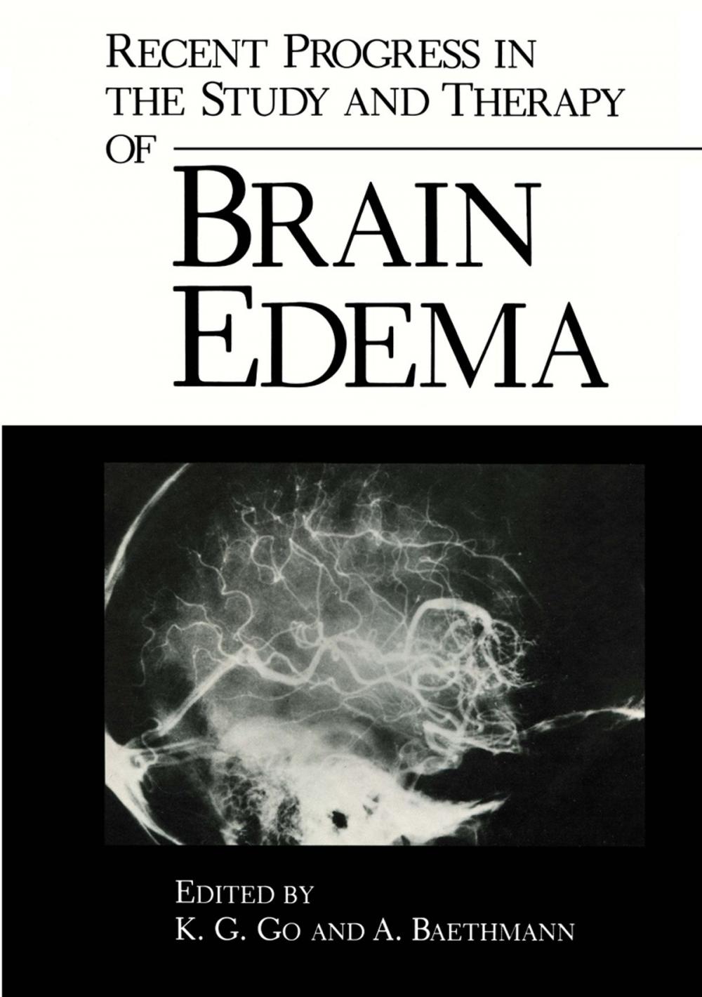 Big bigCover of Recent Progress in the Study and Therapy of Brain Edema