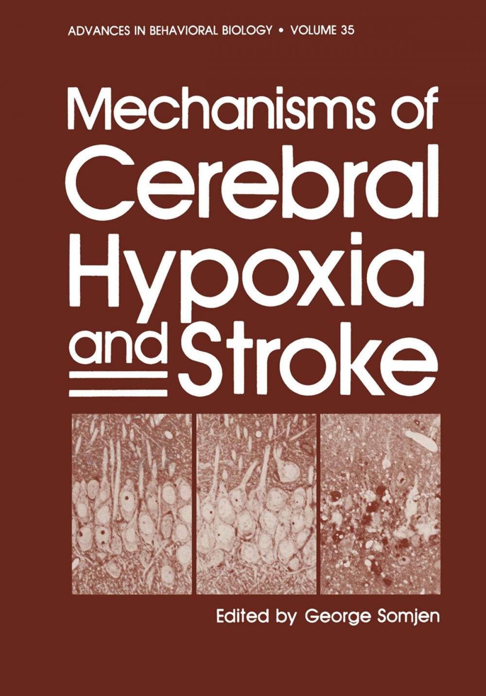 Big bigCover of Mechanisms of Cerebral Hypoxia and Stroke