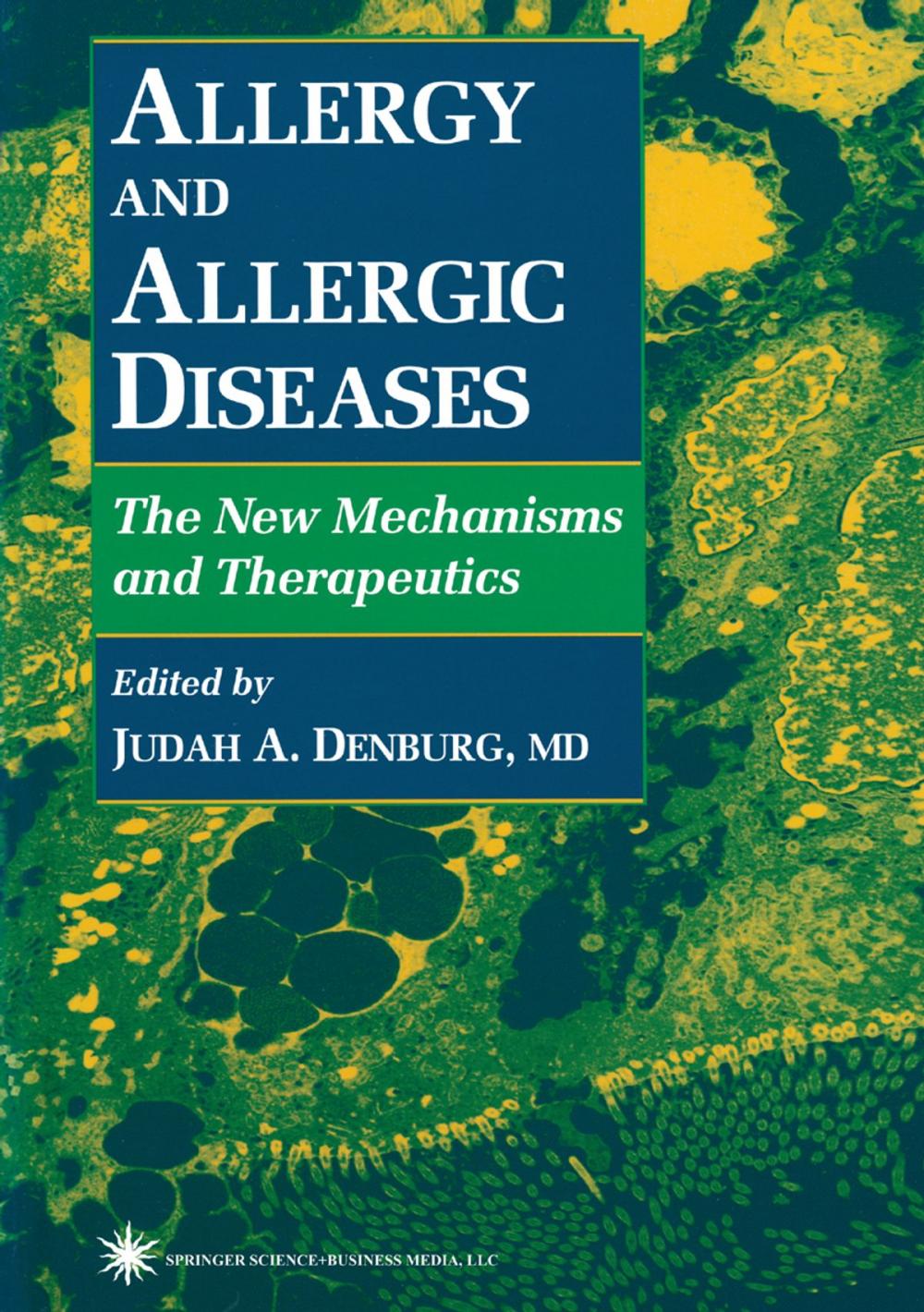 Big bigCover of Allergy and Allergic Diseases