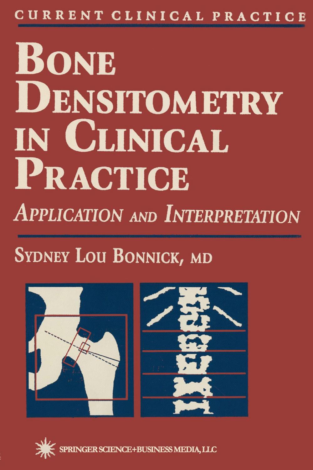 Big bigCover of Bone Densitometry in Clinical Practice