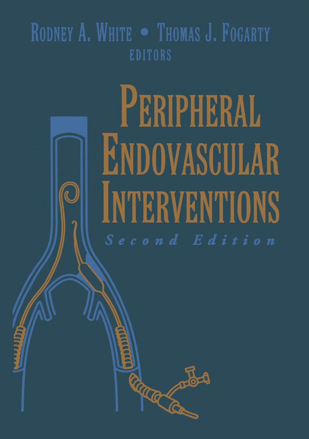 Big bigCover of Peripheral Endovascular Interventions