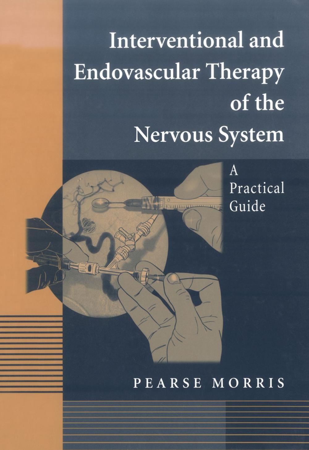 Big bigCover of Interventional and Endovascular Therapy of the Nervous System