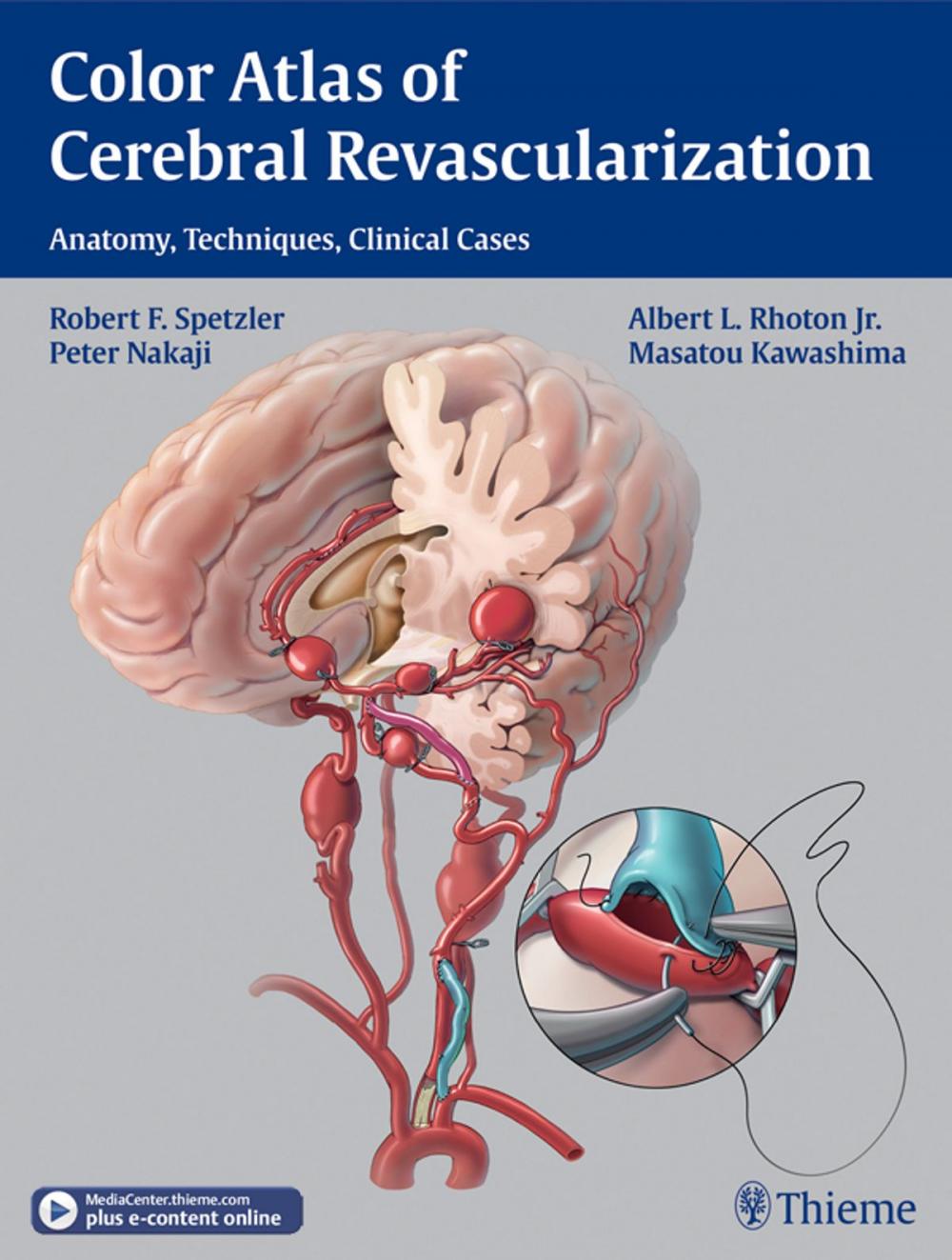 Big bigCover of Color Atlas of Cerebral Revascularization