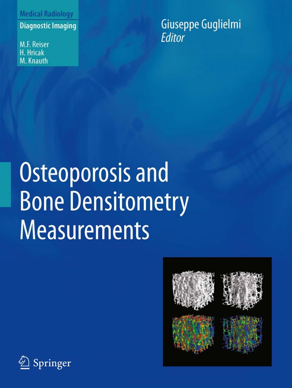 Big bigCover of Osteoporosis and Bone Densitometry Measurements