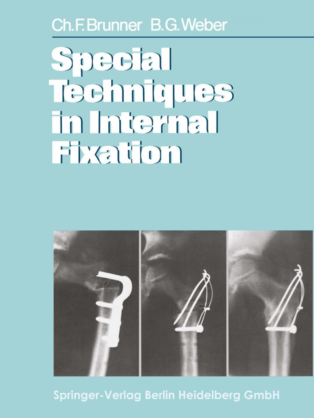 Big bigCover of Special Techniques in Internal Fixation