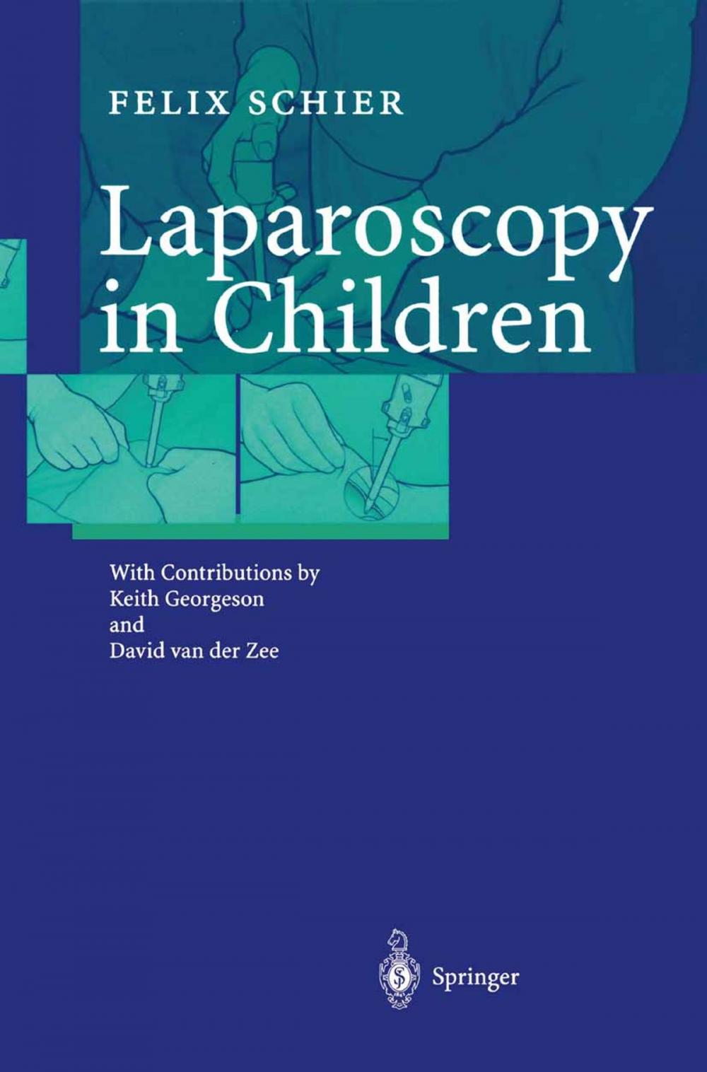 Big bigCover of Laparoscopy in Children