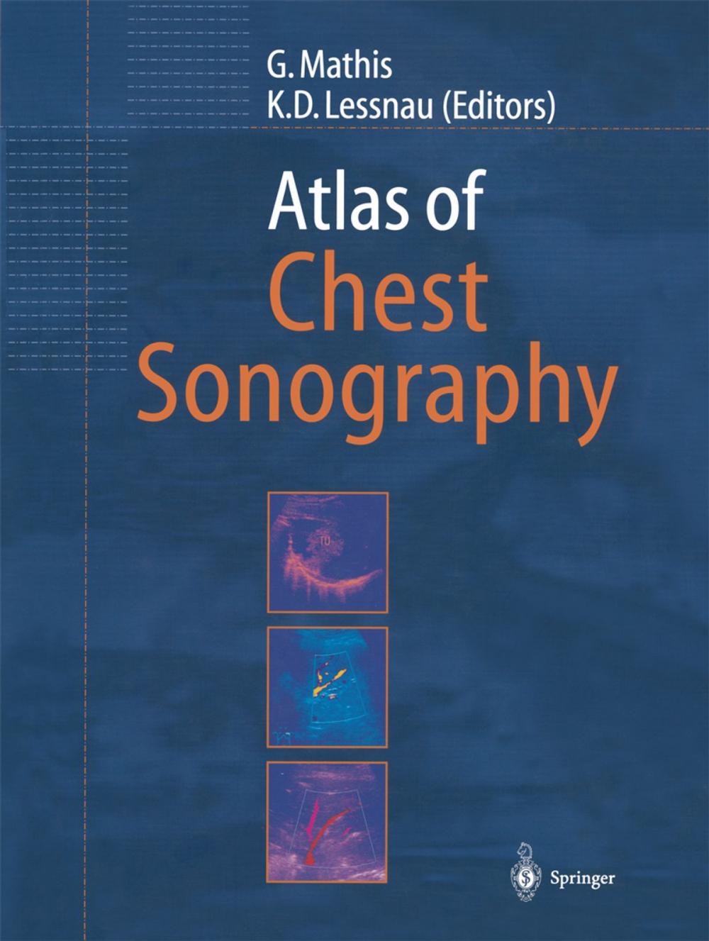 Big bigCover of Atlas of Chest Sonography