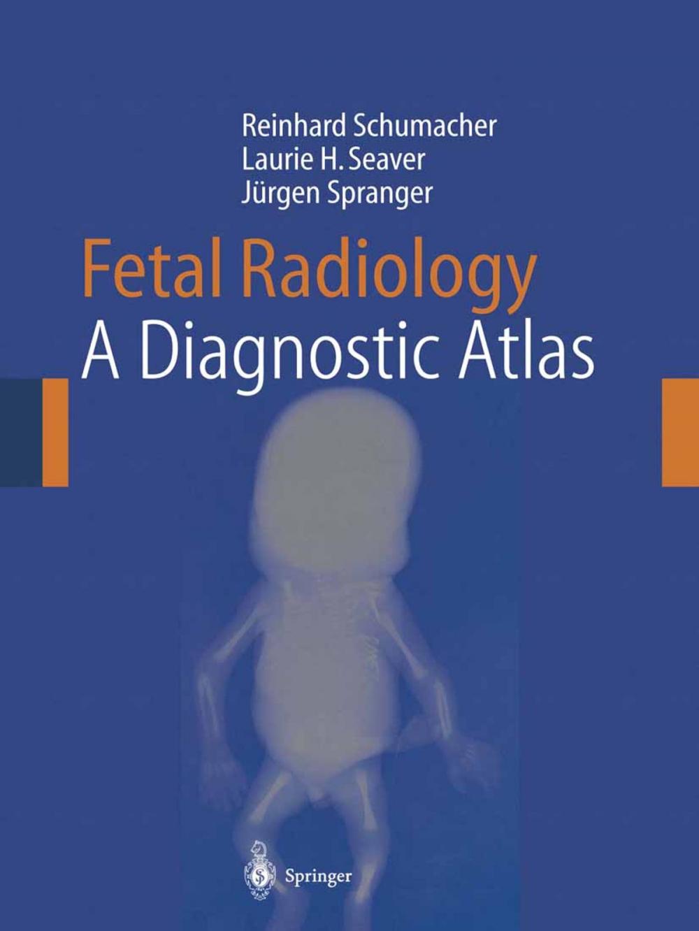 Big bigCover of Fetal Radiology