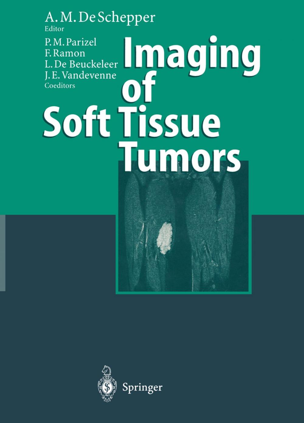 Big bigCover of Imaging of Soft Tissue Tumors