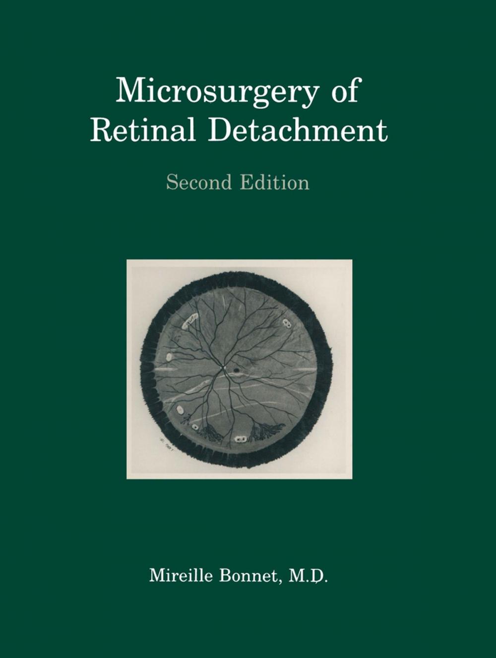 Big bigCover of Microsurgery of Retinal Detachment