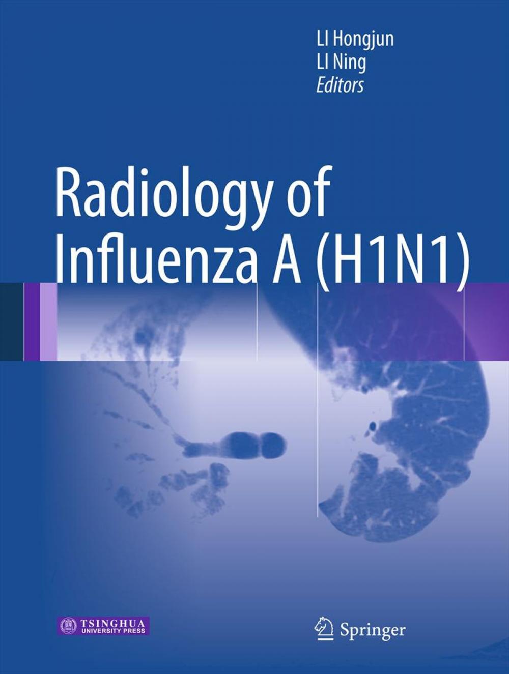 Big bigCover of Radiology of Influenza A (H1N1)