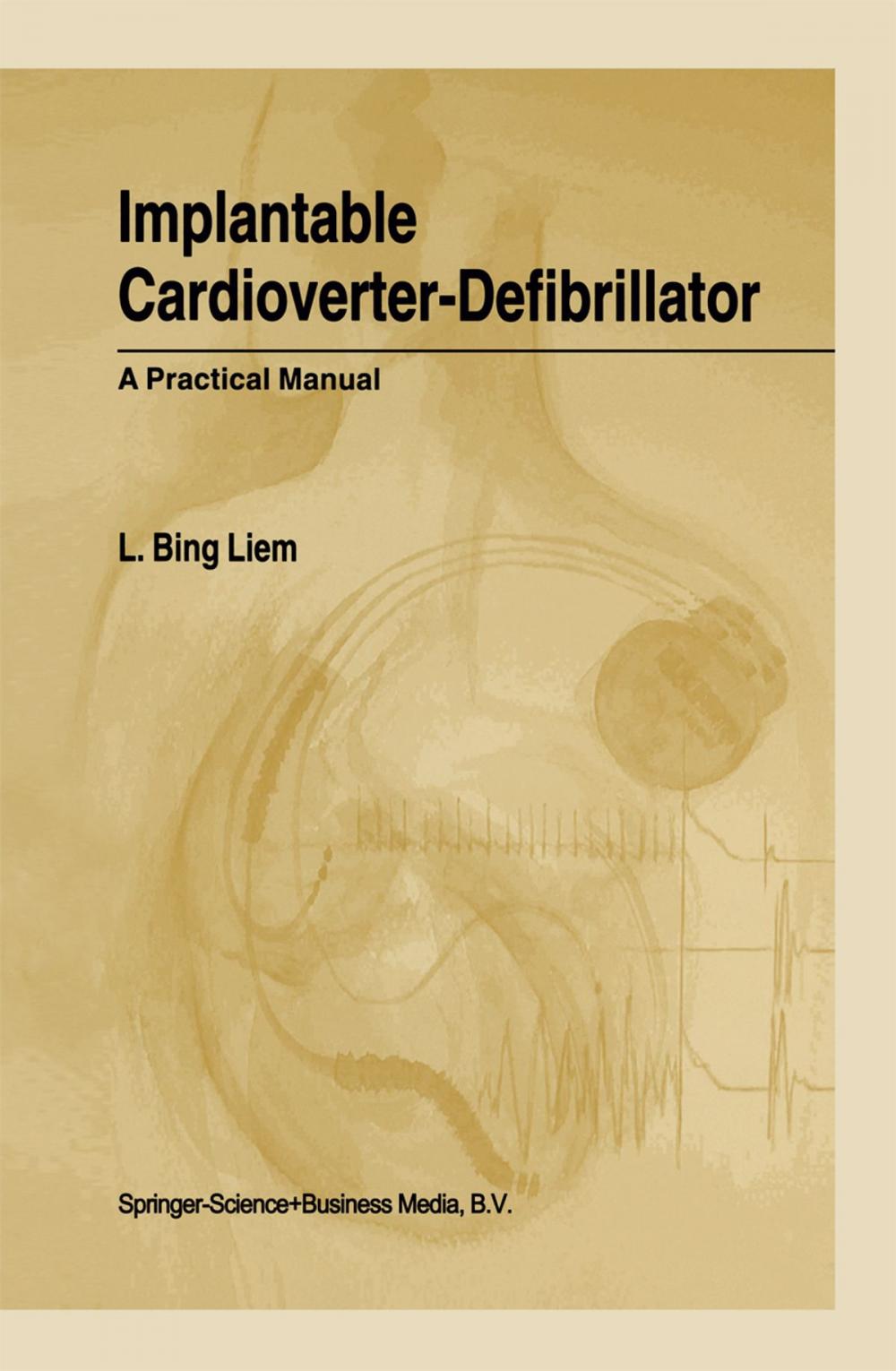 Big bigCover of Implantable Cardioverter-Defibrillator