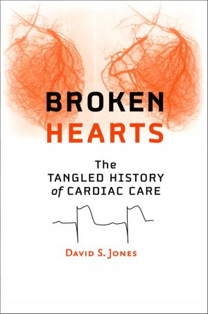 Cover of the book Broken Hearts by Donald F. Kettl