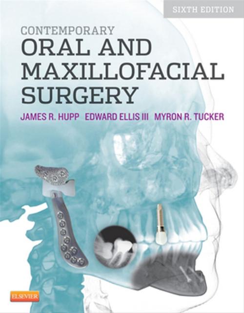 Cover of the book Contemporary Oral and Maxillofacial Surgery - E-Book by James R. Hupp, DMD, MD, JD, MBA, Myron R. Tucker, DDS, Edward Ellis III, DDS, MS, Elsevier Health Sciences