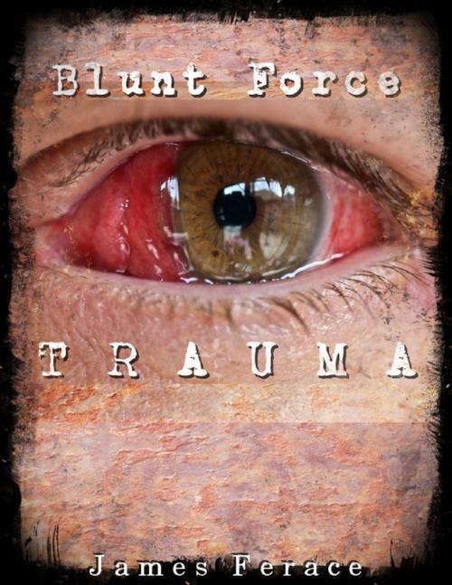 Cover of the book Blunt Force Trauma by James Ferace, Lulu.com