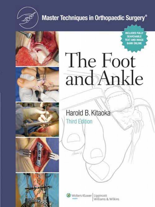 Cover of the book Master Techniques in Orthopaedic Surgery: Foot and Ankle by Harold Kitaoka, Wolters Kluwer Health