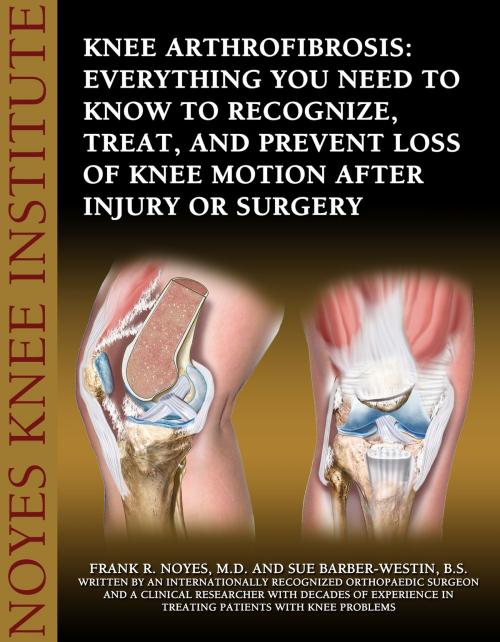 Cover of the book Knee Arthrofibrosis: Everything You Need to Know to Recognize, Treat, and Prevent Loss of Knee Motion After Injury or Surgery by Frank Noyes and Sue Barber-Westin, Publish Green