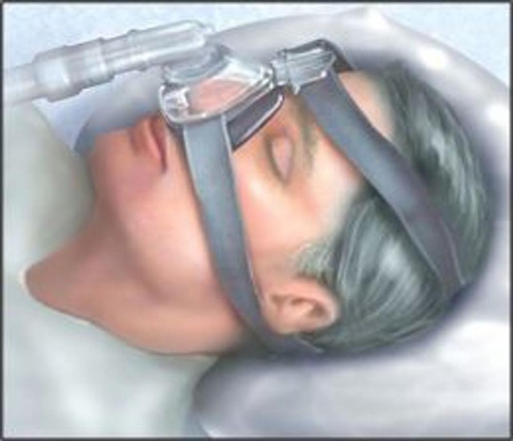 Big bigCover of Sleep Apnea: Causes, Symptoms and Treatments