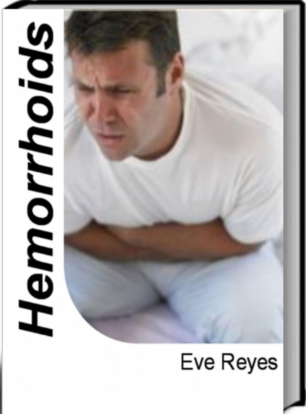 Big bigCover of Hemorrhoids