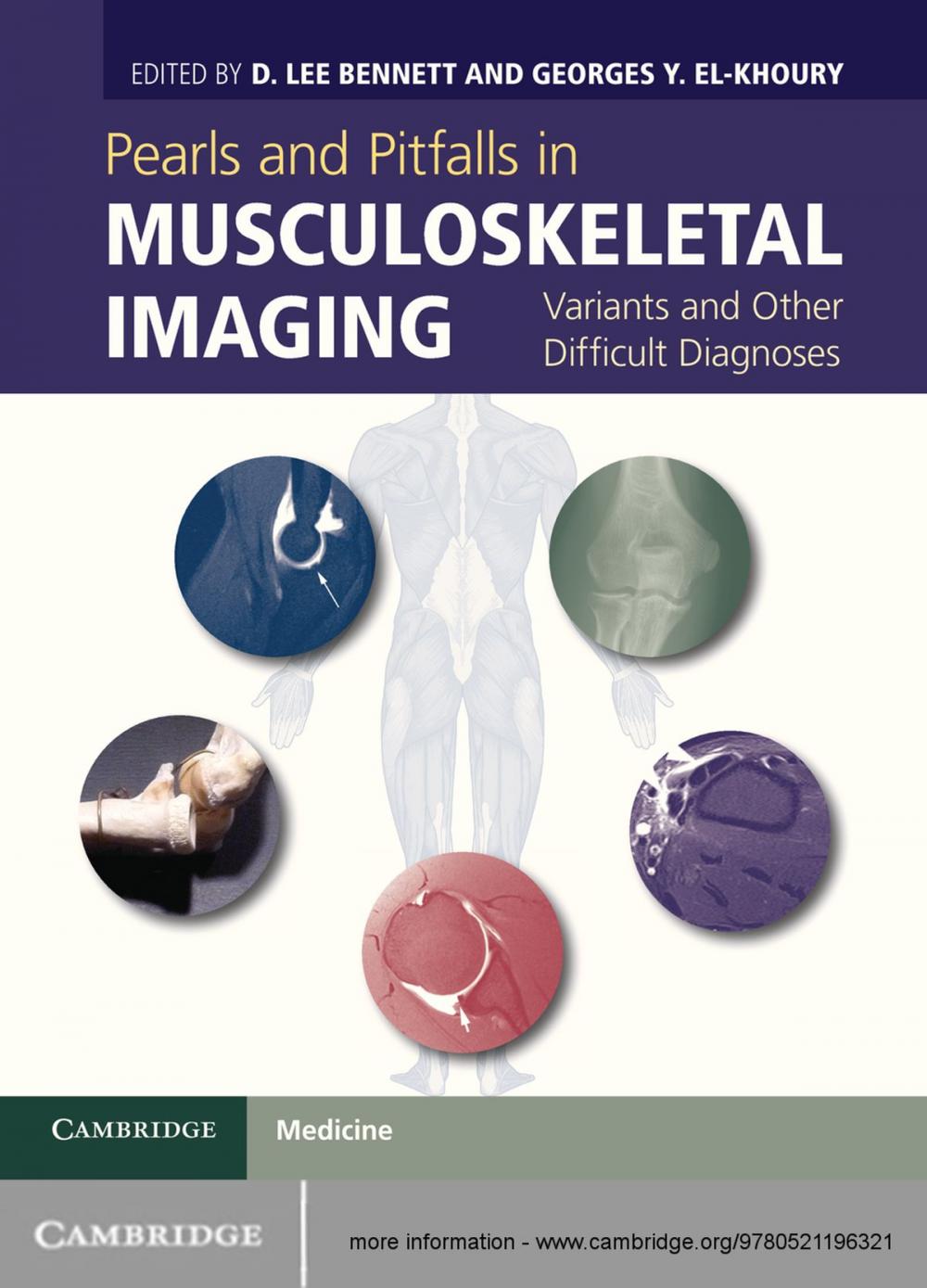 Big bigCover of Pearls and Pitfalls in Musculoskeletal Imaging