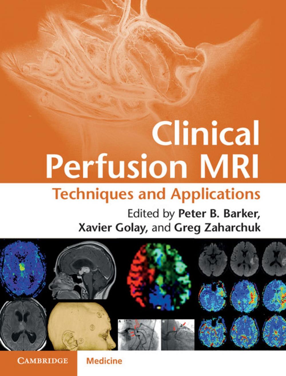 Big bigCover of Clinical Perfusion MRI
