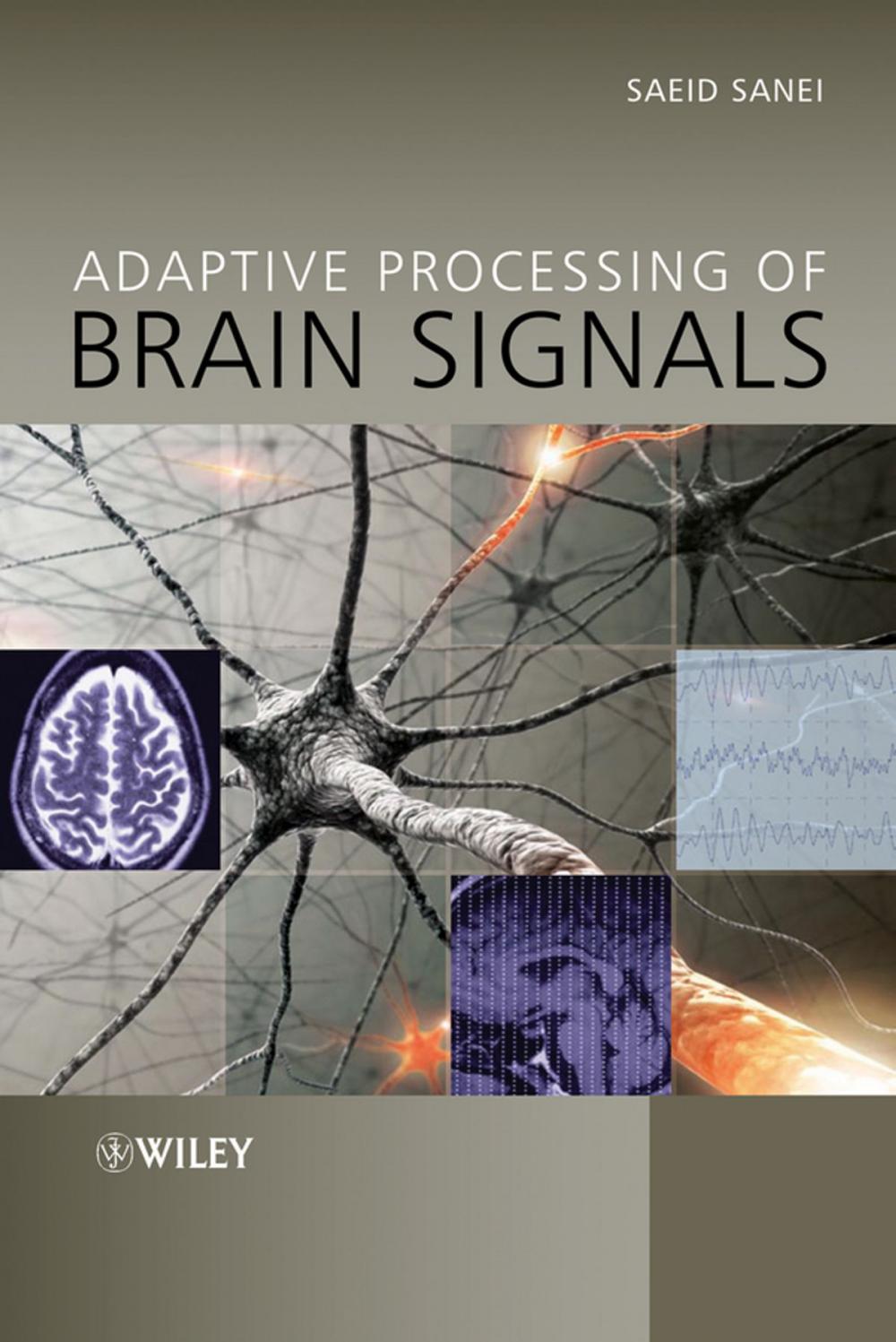 Big bigCover of Adaptive Processing of Brain Signals