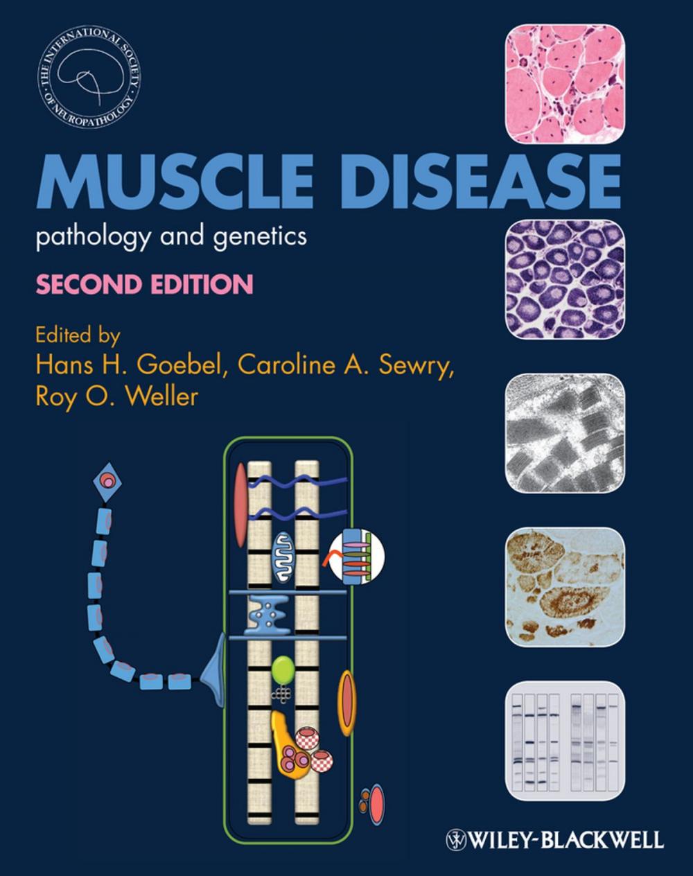 Big bigCover of Muscle Disease