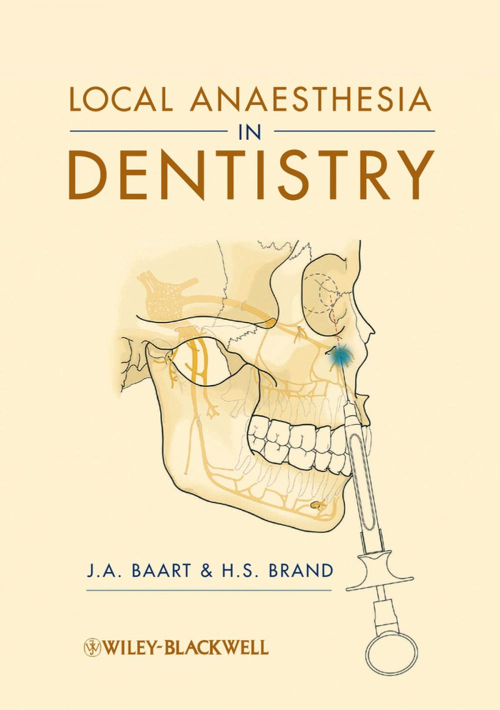 Big bigCover of Local Anaesthesia in Dentistry