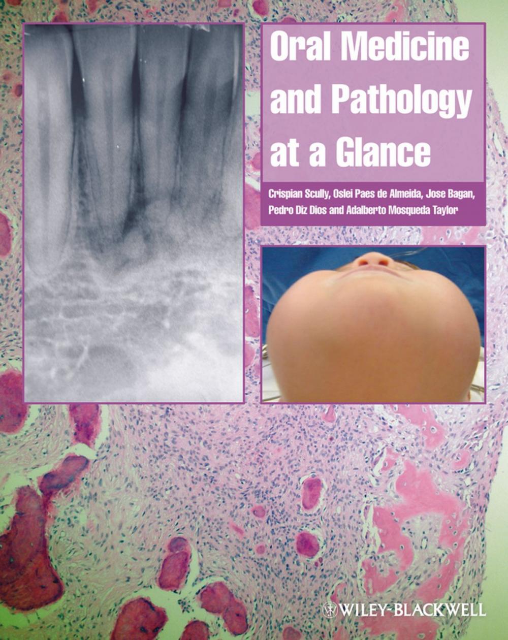 Big bigCover of Oral Medicine and Pathology at a Glance