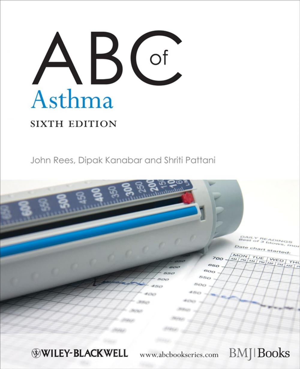 Big bigCover of ABC of Asthma