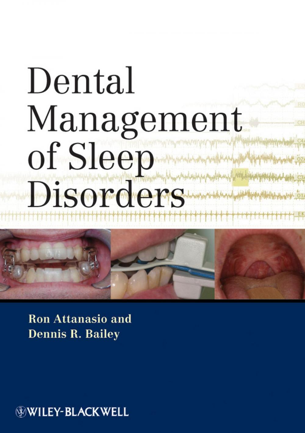 Big bigCover of Dental Management of Sleep Disorders