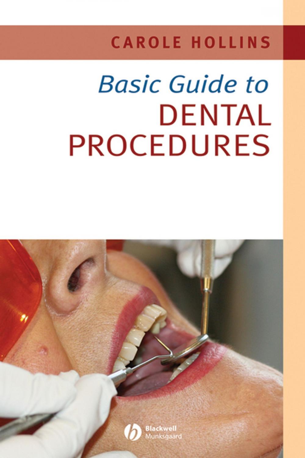 Big bigCover of Basic Guide to Dental Procedures