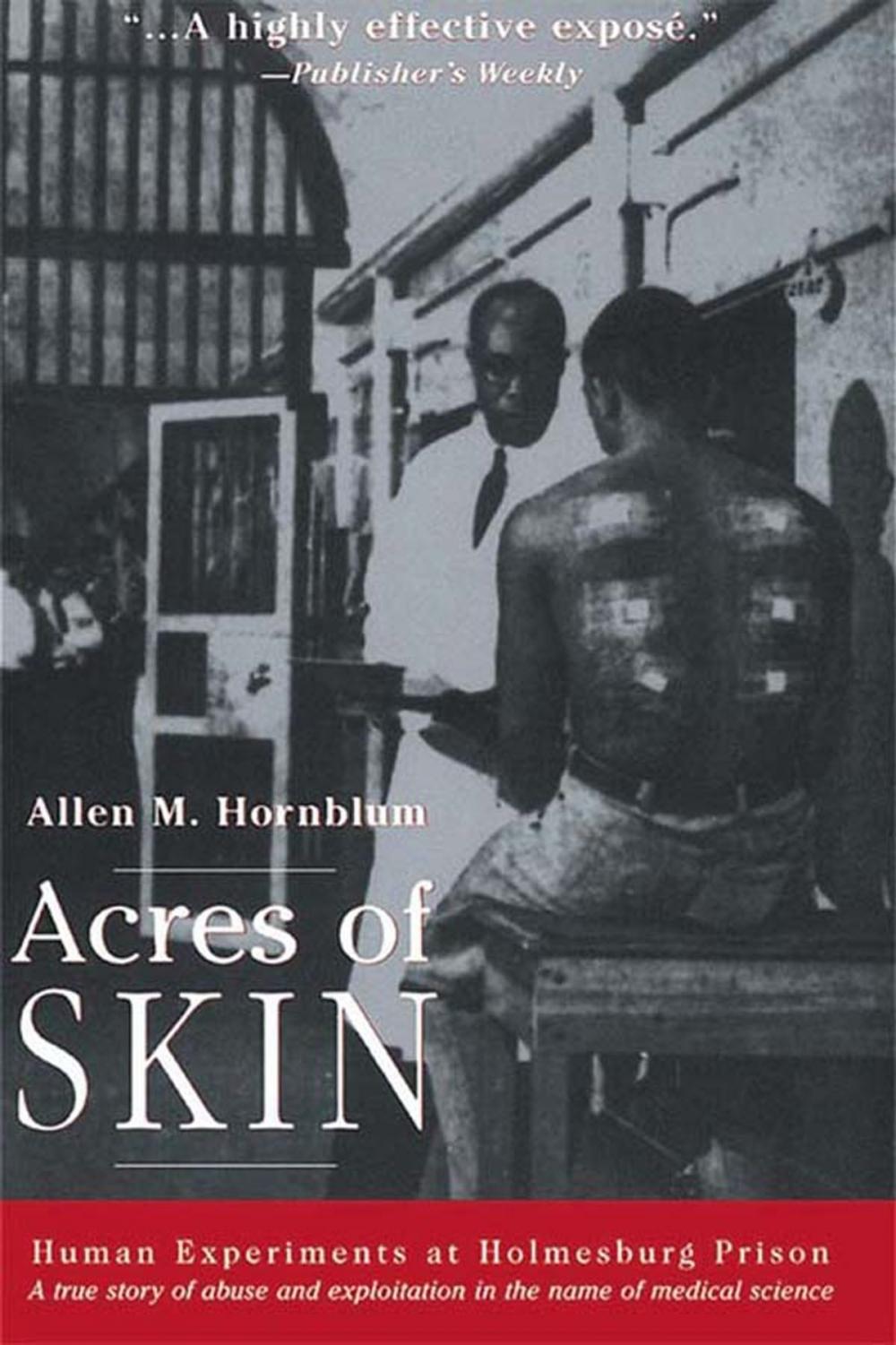 Big bigCover of Acres of Skin