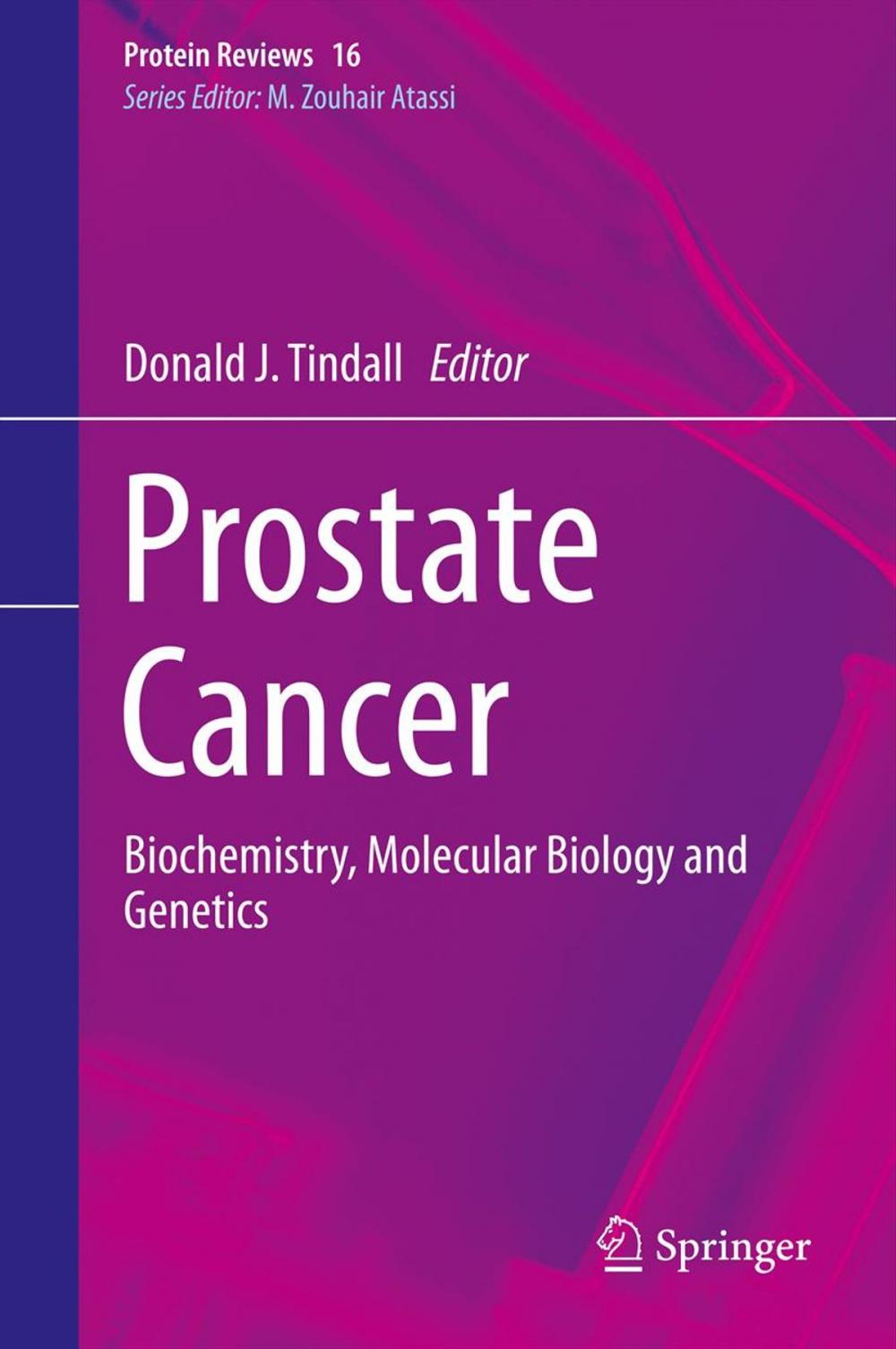 Big bigCover of Prostate Cancer