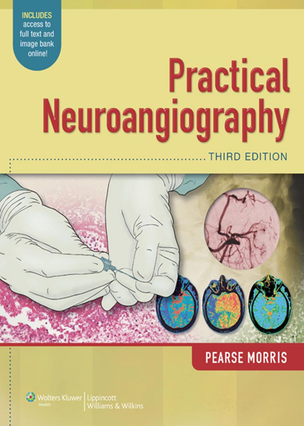 Big bigCover of Practical Neuroangiography