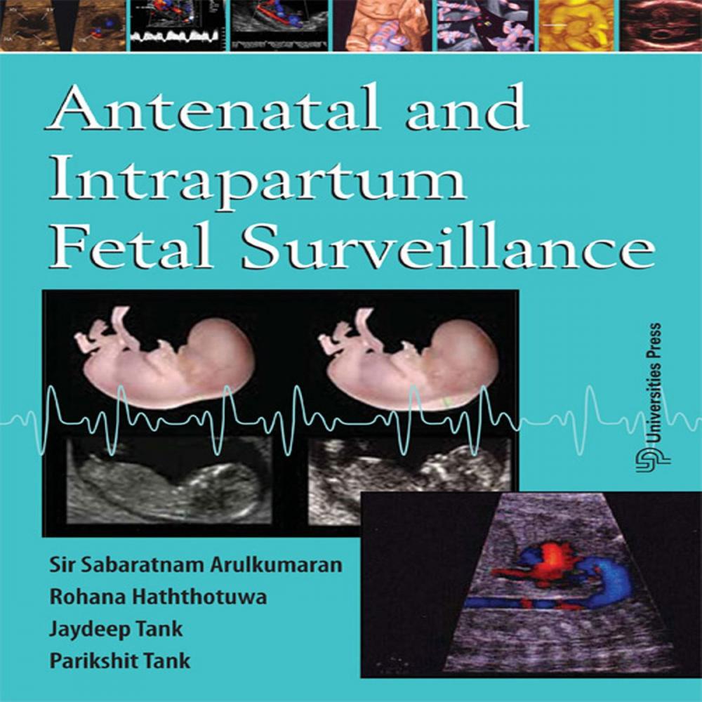 Big bigCover of Antenatal and Intrapartum Fetal Surveilance