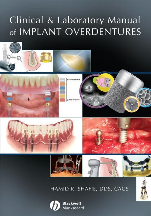 Cover of the book Clinical and Laboratory Manual of Implant Overdentures by Hamid R. Shafie, Wiley