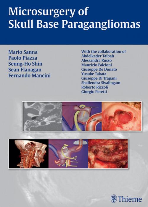 Cover of the book Microsurgery of Skull Base Paragangliomas by Mario Sanna, Paolo Piazza, Seung-Ho Shin, Thieme